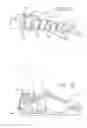 Fig. 12 - Tissue stabilization system