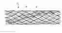 Fig. 01 - Helical formation for a conduit