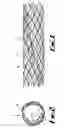 Fig. 02 - Helical formation for a conduit