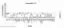Fig. 11 - Gene expression profiling technology for treatment evaluation of multiple sclerosis