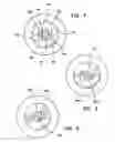 Fig. 05 - Bladeless optical obturator
