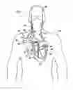 Fig. 02 - Applications of vagal stimulation