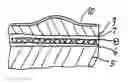 Fig. 01 - Three dimensionally deformable heating element, steering-wheel heater and method for producing a steering-wheel heater