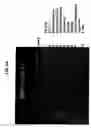 Fig. 07 - Monoclonal antibodies and cell surface antigens for the detection and treatment of small cell lung cancer (SCLC)