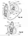 Fig. 46 - Shutter-type covering for architectural openings