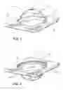 Fig. 02 - Packaged bulbous light diffuser
