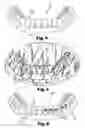 Fig. 03 - Apparatus for indirect bonding of orthodontic appliances and method of making the same