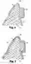 Fig. 04 - Apparatus for indirect bonding of orthodontic appliances and method of making the same