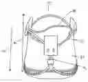 Fig. 01 - Minimally invasive valve replacement system