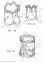 Fig. 05 - Minimally invasive valve replacement system