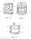 Fig. 08 - Minimally invasive valve replacement system