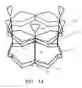 Fig. 09 - Minimally invasive valve replacement system