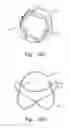 Fig. 10 - Minimally invasive valve replacement system