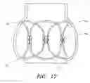 Fig. 12 - Minimally invasive valve replacement system