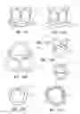 Fig. 16 - Minimally invasive valve replacement system