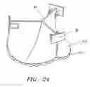 Fig. 19 - Minimally invasive valve replacement system