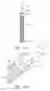Fig. 26 - Minimally invasive valve replacement system