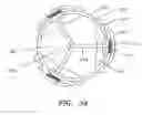 Fig. 29 - Minimally invasive valve replacement system