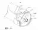 Fig. 30 - Minimally invasive valve replacement system