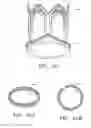 Fig. 35 - Minimally invasive valve replacement system