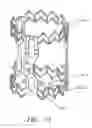 Fig. 40 - Minimally invasive valve replacement system