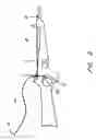 Fig. 06 - Kwick-cock