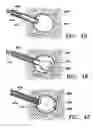 Fig. 08 - Biopsy site marker