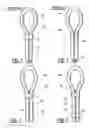 Fig. 02 - Castration loop