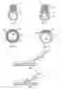 Fig. 03 - Closure device