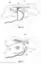 Fig. 07 - Drawstringing kit