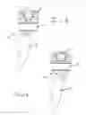 Fig. 03 - Bone fixation system with low profile fastener