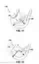 Fig. 07 - Implantable devices and methods for treating urinary incontinence