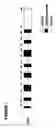 Fig. 02 - Tumor suppressor gene, p28ING5