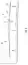 Fig. 08 - Method and system for regulating pressure and optimizing fluid flow about a fuselage similar body