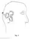 Fig. 03 - Head worn entertainment and/or communication device