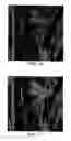 Fig. 09 - Progressive image transmission using discrete wavelet transforms