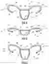 Fig. 06 - Guide handle for a manually steered machine