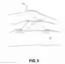 Fig. 05 - Method of forming an artificial reef for shaping waves and a method for removing an artificial reef