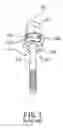 Fig. 02 - Fastener assembly