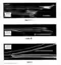 Fig. 07 - Macroscopic fiber comprising single-wall carbon nanotubes and acrylonitrile-based polymer 
and process for making the same