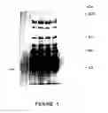Fig. 02 - Platelet-activating factor acetylhydrolase