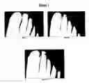 Fig. 02 - Use of topical compositions for the control of microbial diseases of the nail