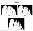 Fig. 03 - Use of topical compositions for the control of microbial diseases of the nail