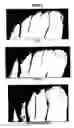 Fig. 06 - Use of topical compositions for the control of microbial diseases of the nail