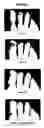 Fig. 07 - Use of topical compositions for the control of microbial diseases of the nail