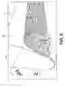 Fig. 07 - Filter system