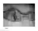 Fig. 09 - Cyclic implant perfusion, cleaning and passivation process and implant produced thereby