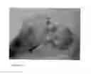 Fig. 10 - Cyclic implant perfusion, cleaning and passivation process and implant produced thereby