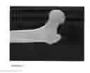 Fig. 11 - Cyclic implant perfusion, cleaning and passivation process and implant produced thereby