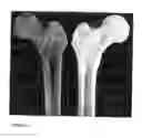 Fig. 12 - Cyclic implant perfusion, cleaning and passivation process and implant produced thereby